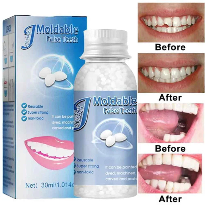 TeethRepair™ : Kit De Réparation De Dents A L’Apparence Naturelle